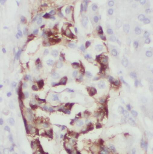 PLAT antibody|PLAT抗体