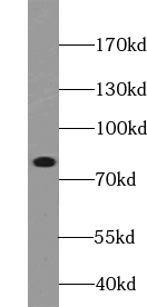 ABCB10 antibody|ABCB10抗体
