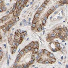 KRT18 antibody|KRT18抗体 FNab022