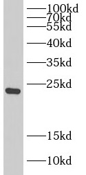 DIRAS1 antibody|DIRAS1抗体