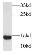 S100A9 antibody|S100A9抗体