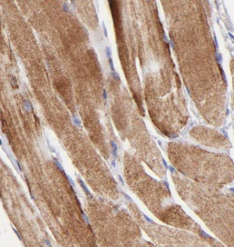 CAMK2G-Specific antibody|CAMK2