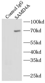 RGMA antibody|RGMA抗体