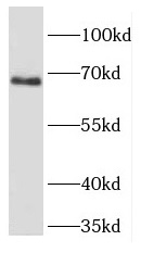 FIGNL1 antibody|FIGNL1抗体