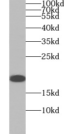 KRAS antibody|KRAS抗体 FNab04641