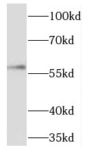 TBX5 antibody|TBX5抗体