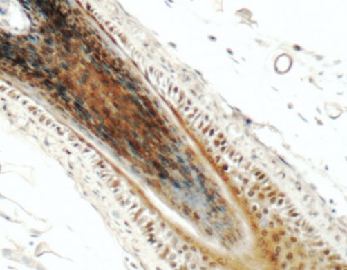 PINX1 antibody|PINX1抗体