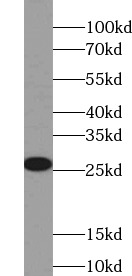 PRDX3 antibody|PRDX3抗体 FNab063