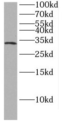 HAAO antibody|HAAO抗体