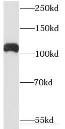 ARHGEF2 antibody|ARHGEF2抗体