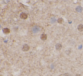 ARFGAP1 antibody|ARFGAP1抗体 FNa