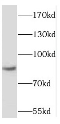 RBM28 antibody|RBM28抗体