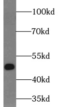 MAK16 antibody|MAK16抗体