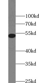 DES antibody|DES抗体 FNab02340