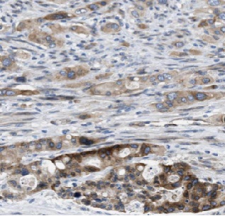 RPS28 antibody|RPS28抗体