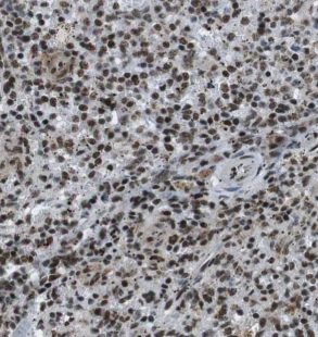 EXOSC10 antibody|EXOSC10抗体 FNa