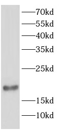 SUB1 antibody|SUB1抗体 FNab08367