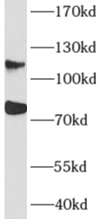 AFAP1 antibody|AFAP1抗体