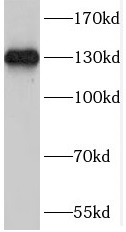 SAP130 antibody|SAP130抗体