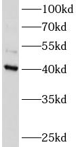 ATXN3L antibody|ATXN3L抗体 FNab0