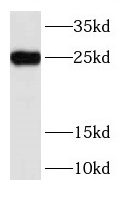 RAB5A-Specific antibody|RAB5A抗