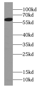 TXLNG antibody|TXLNG抗体