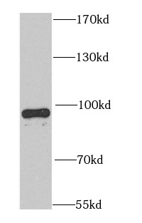 PDE4D antibody|PDE4D抗体