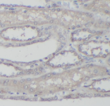ABCC6 antibody|ABCC6抗体