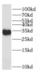 TACO1 antibody|TACO1抗体