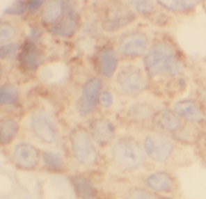 EML4 antibody|EML4抗体 FNab10047