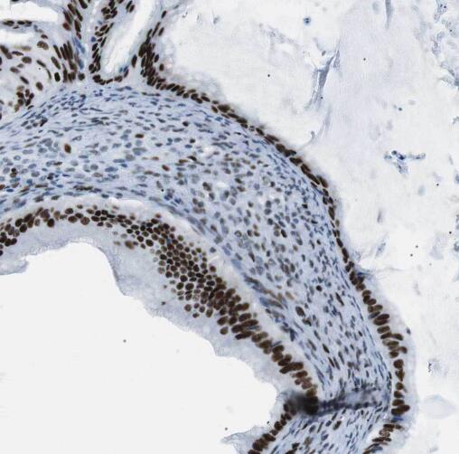 SP100 antibody|SP100抗体