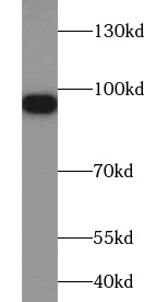 VIL1 antibody|VIL1抗体 FNab09406
