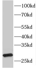 HLA-DQA2 antibody|HLA-DQA2抗体