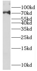 PAPSS2 antibody|PAPSS2抗体