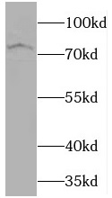 CRTC1 antibody|CRTC1抗体