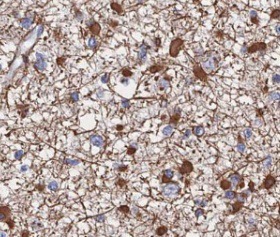 TPP2 antibody|TPP2抗体 FNab08895