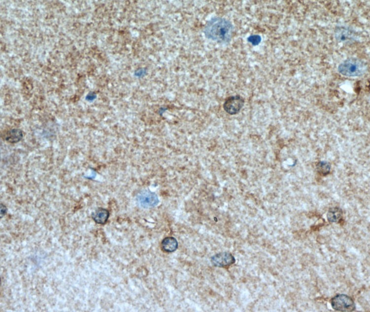 ALDH1L1 antibody|ALDH1L1抗体