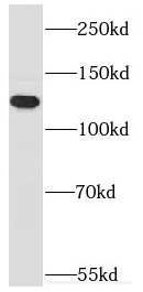 MYO1E antibody|MYO1E抗体
