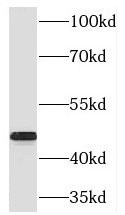 RIMKLB antibody|RIMKLB抗体