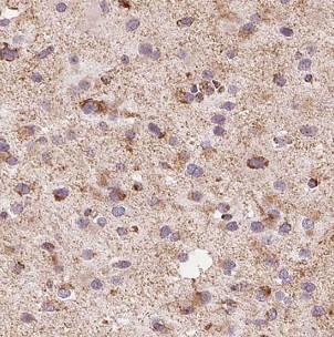 MAOB antibody|MAOB抗体 FNab04971