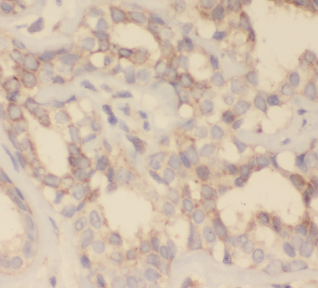 SH2D3C antibody|SH2D3C抗体