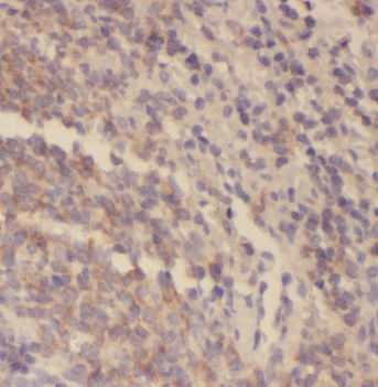 SYK antibody|SYK抗体 FNab08414