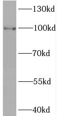 BRIP1 antibody|BRIP1抗体 FNab009