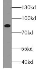 TRPC1 antibody|TRPC1抗体