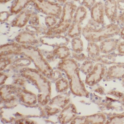 PPP6R3 antibody|PPP6R3抗体