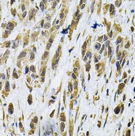 RHOA antibody|RHOA抗体