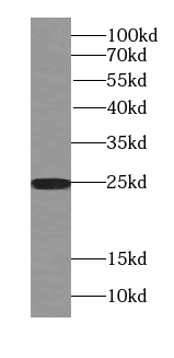 RAB3A-specific antibody|RAB3A抗