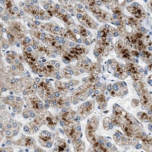 BAAT antibody|BAAT抗体