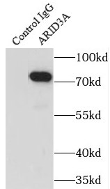 AIDA antibody|AIDA抗体