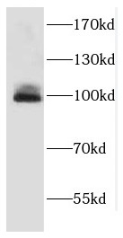 EIF4G2 antibody|EIF4G2抗体